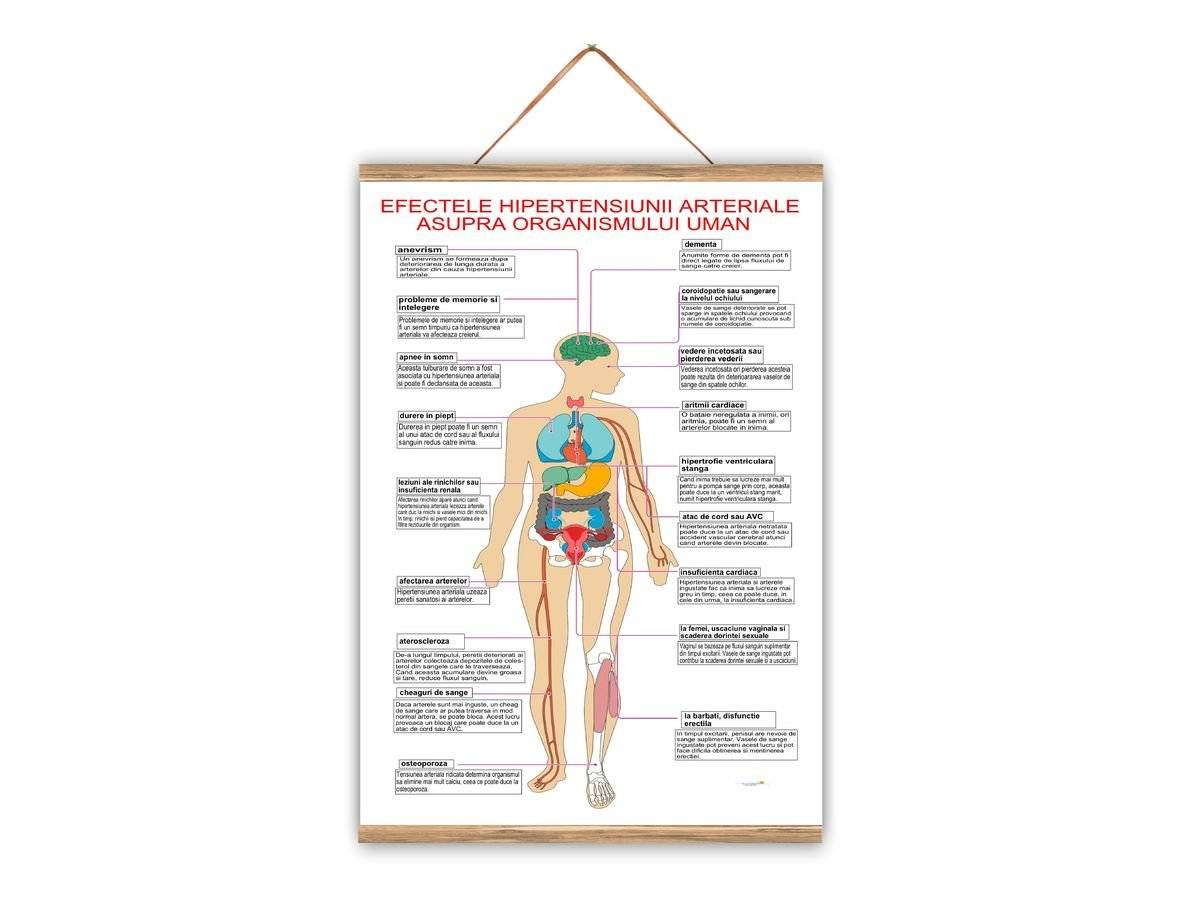 Plansa medicala - Hipertensiunea arteriala- Efecte