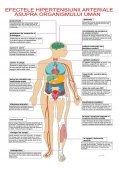 Plansa tematica - Hipertensiunea arteriala- Efecte